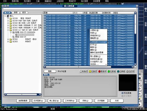 醫學影像信息系統(PACS)源碼基礎解析 架構、原理與數據處理服務